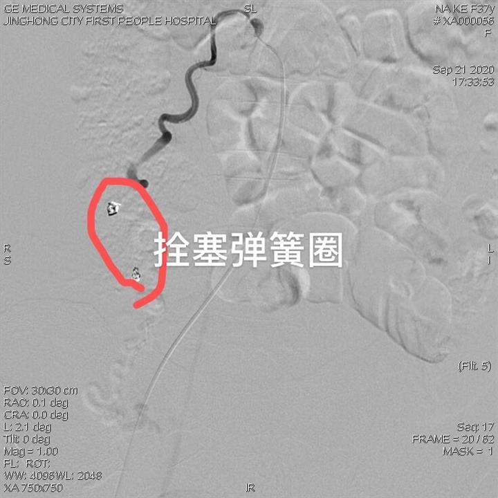 20201209175051_7644
